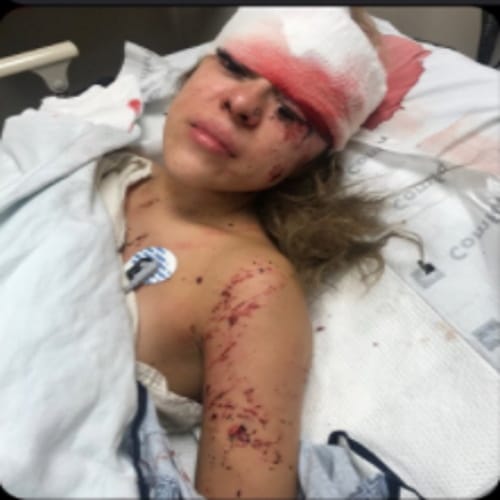 Woman Shouts Out Beautician For ‘Poppin Lashes’ That Stayed In Place After Terrible Car Crash