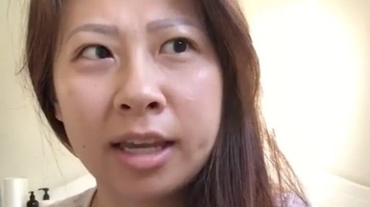 tonsil surgery