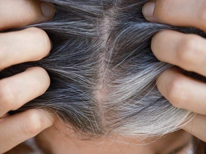 Woman showing gray hair roots.