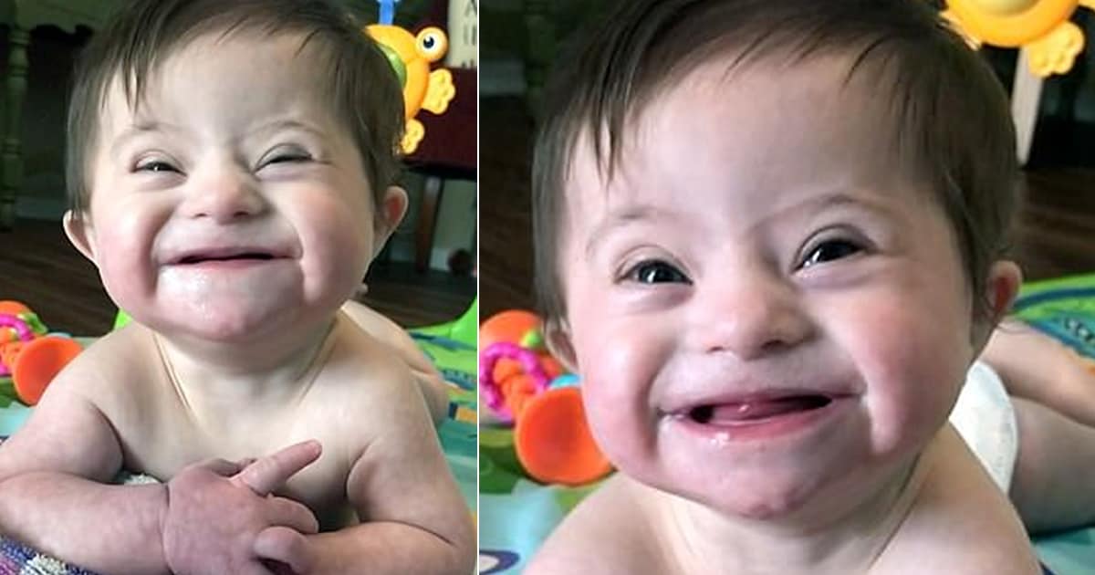 baby girl down syndrome smile