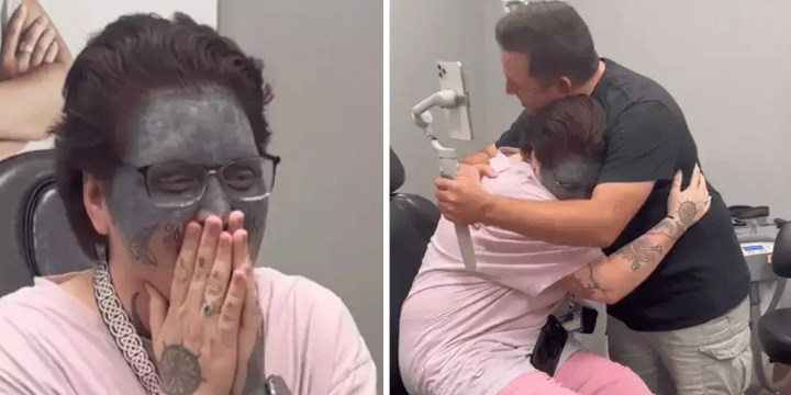 tattooed face woman laser removal