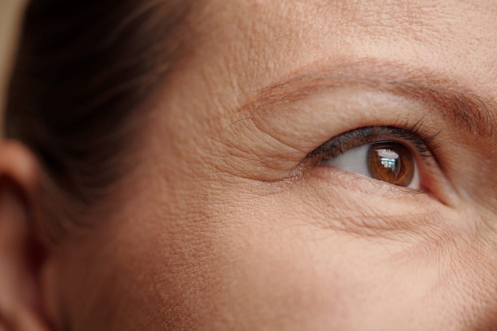Woman with laugh lines at her eyes.