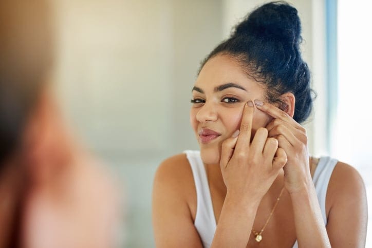 One pimple can change your entire day