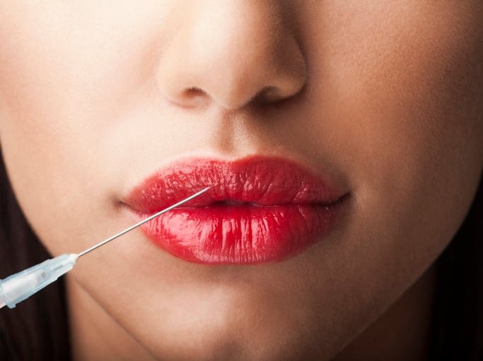 Anti-aging pic of woman getting botox or her lips plumped.