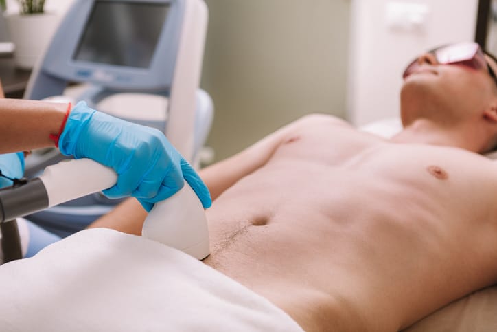 male laser hair removal