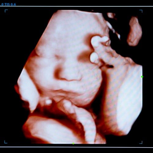 ohio abortion