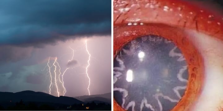 lightning strike and eye mark