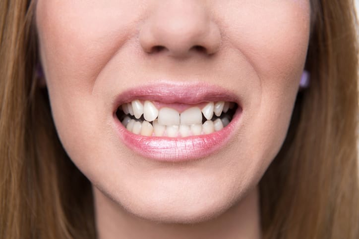 Woman smiling.