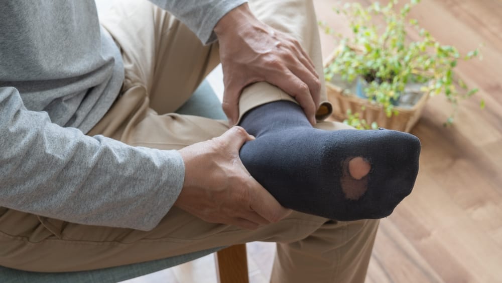 Man with a ripped sock on his foot.