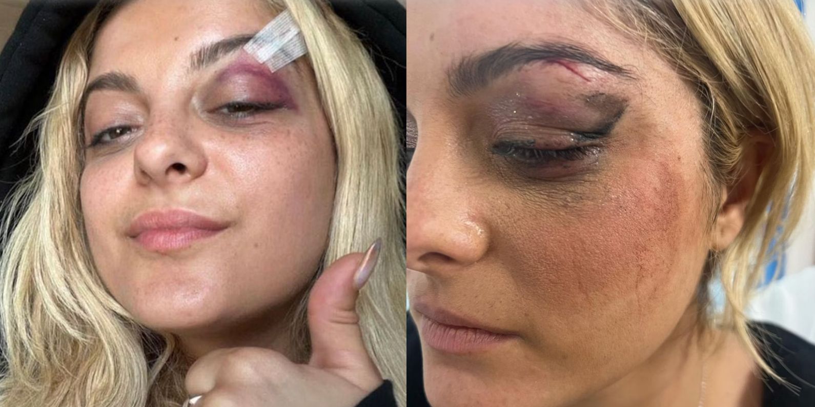Man Who Threw Phone At Bebe Rexha At NYC Concert ‘Thought It Would Be Funny’