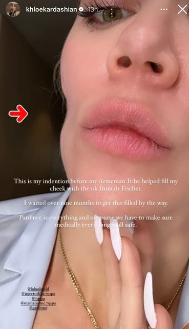 khloe kardashian showing cheek instagram