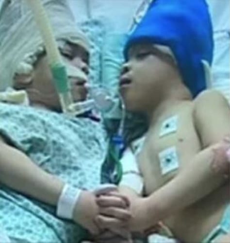 3-Year-Old Conjoined Twins Successfully Separated After Incredible Virtual Reality Surgery
