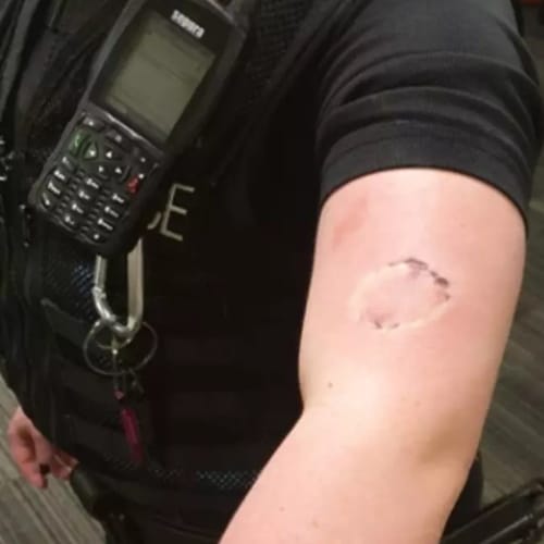 Police Officer Left With Teeth Marks After Being Bitten By Man Ignoring Lockdown