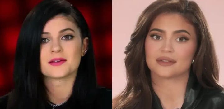 Kylie Jenner Admits She Doesn’t Want Her Kids To Copy Her Cosmetic Surgery Choices