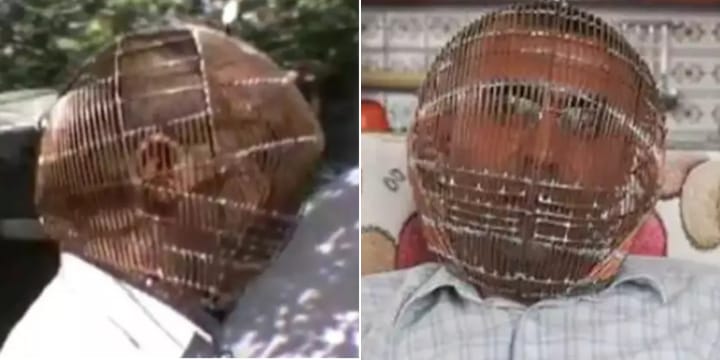 Man Locks His Own Head In A Cage To Try To Quit Smoking