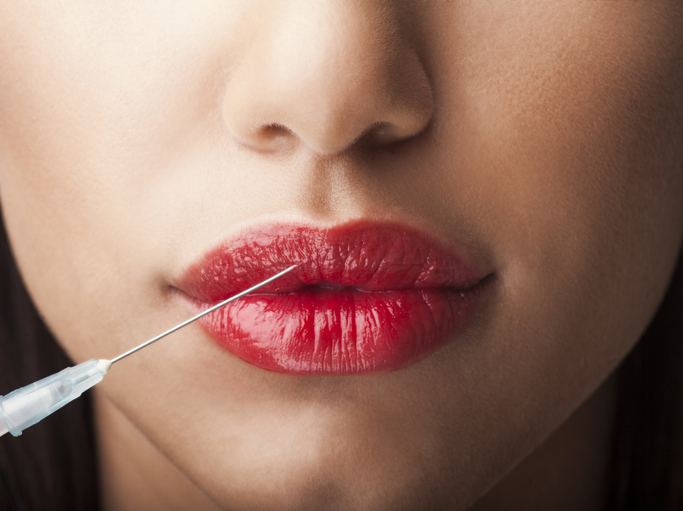 Anti-aging pic of woman getting botox or her lips plumped.