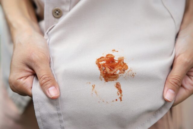 Stained clothing.