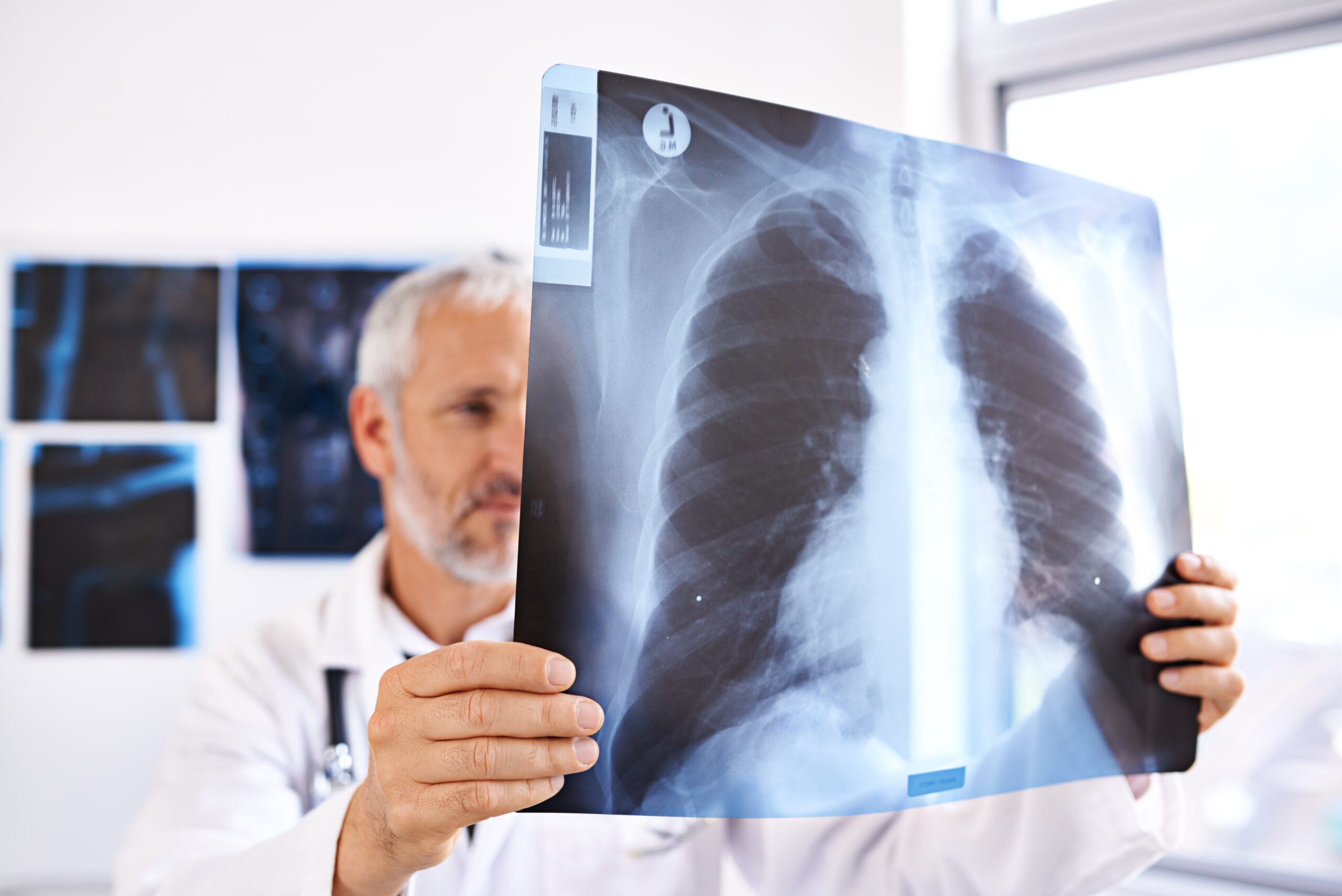 Doctor looking at a lung x-ray.