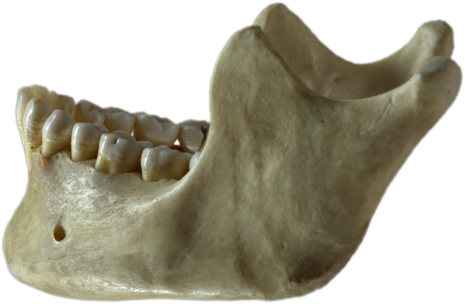 A human jawbone.