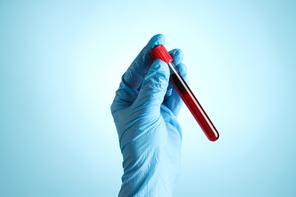 A test tube with donor blood.