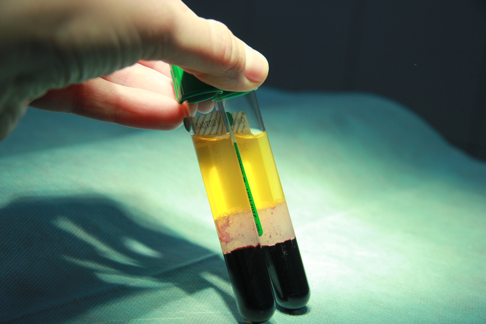 Vials of blood, medical healthcare image