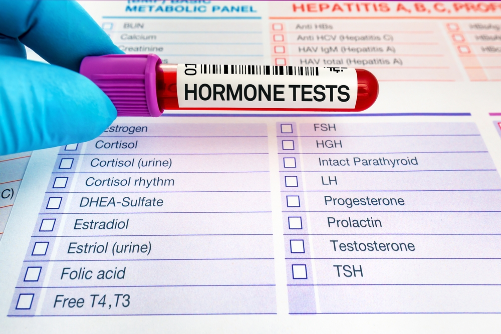 Hormone test